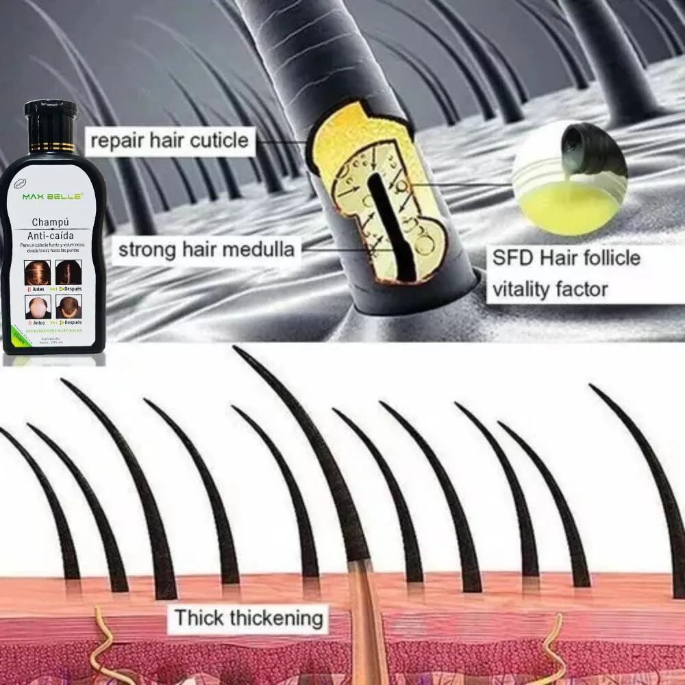 Champú Anticaída MAX BELLE  200ml – Más volumen, fuerza y crecimiento natural