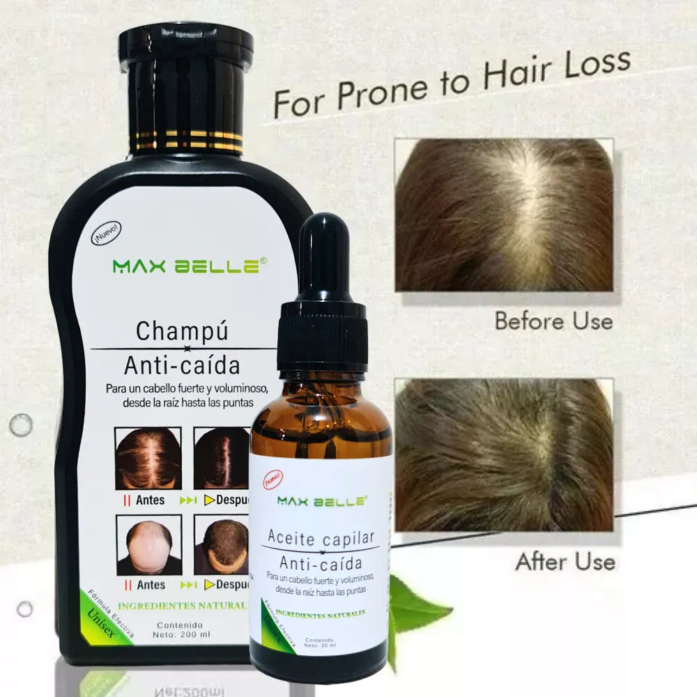 Champú Anticaída MAX BELLE  200ml – Más volumen, fuerza y crecimiento natural